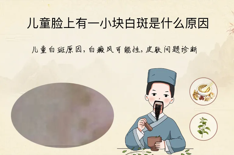 儿童脸上有一小块白斑是什么原因