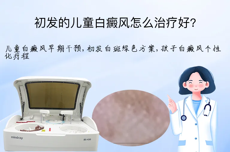 初发的儿童白癜风怎么治疗好?