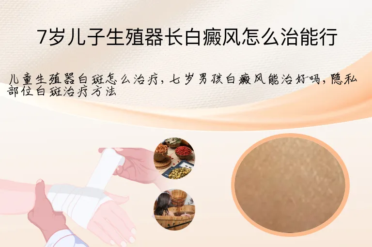 7岁儿子生殖器长白癜风怎么治能行