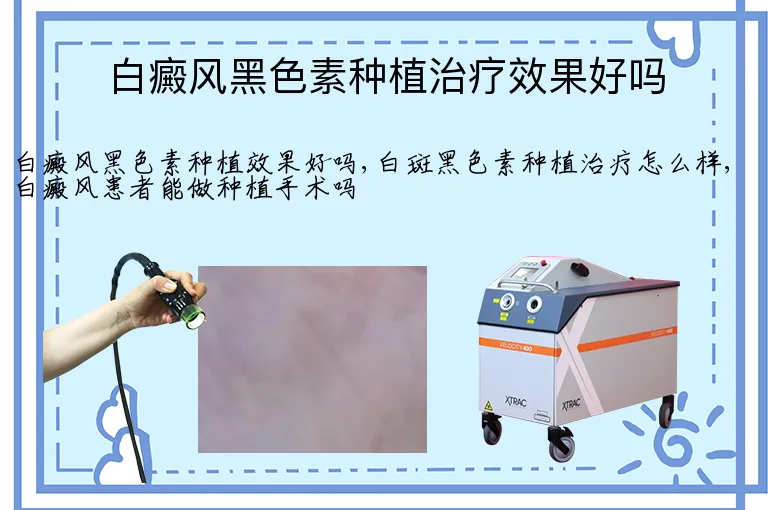 白癜风黑色素种植治疗效果好吗