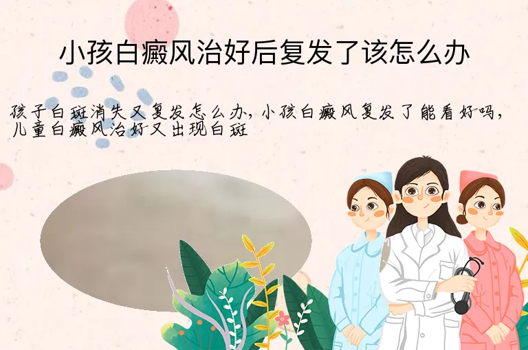 小孩白癜风治好后复发了该怎么办