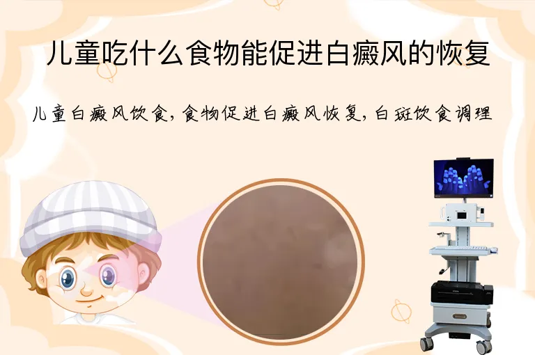 儿童吃什么食物能促进白癜风的恢复