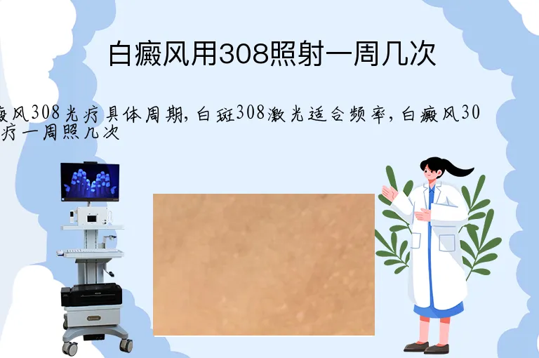 白癜风用308照射一周几次