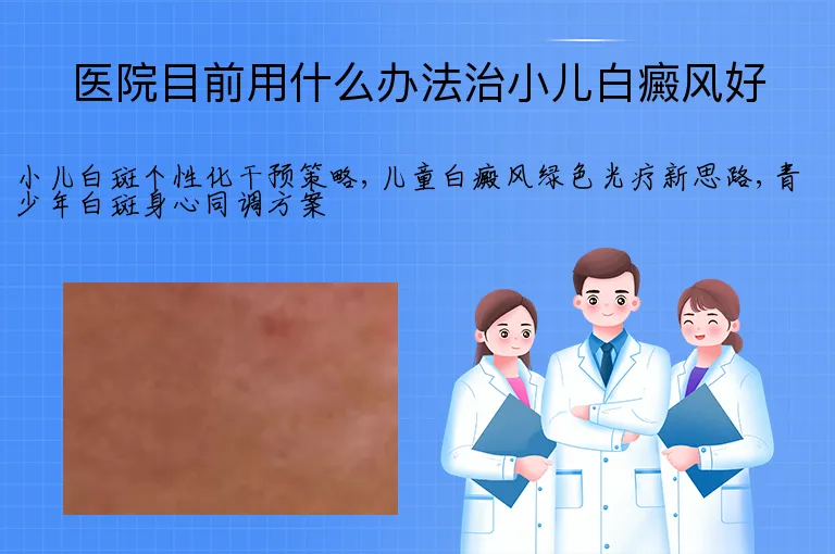 医院目前用什么办法治小儿白癜风好