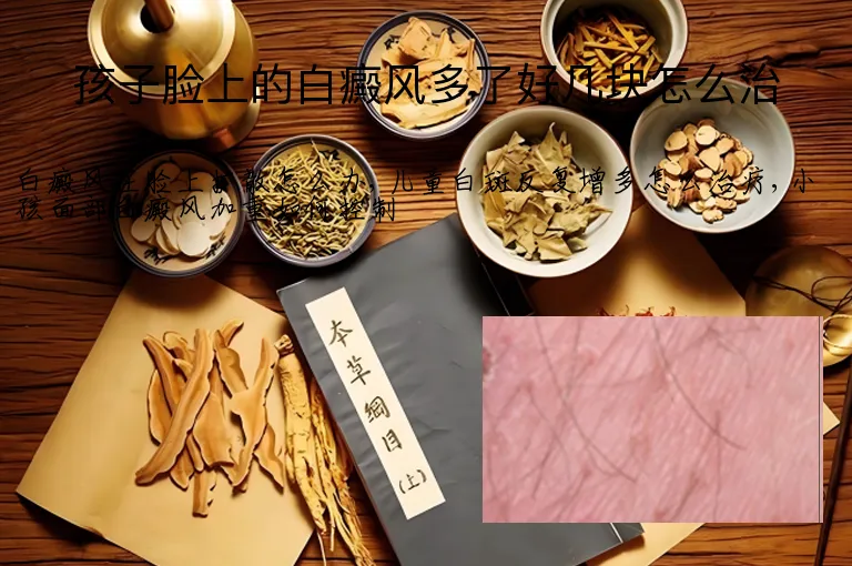 孩子脸上的白癜风多了好几块怎么治
