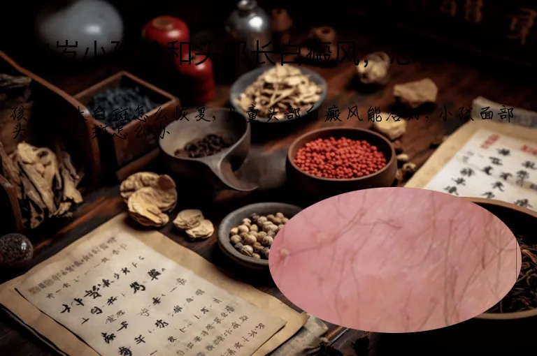 4岁小孩脸和头部长白癜风,怎么治好