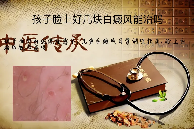 孩子脸上好几块白癜风能治吗