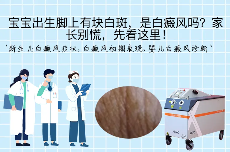 宝宝出生脚上有块白斑，是白癜风吗？家长别慌，先看这里！