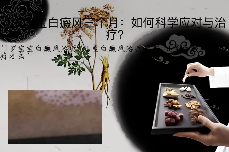 1岁宝宝白癜风三个月：如何科学应对与治疗？