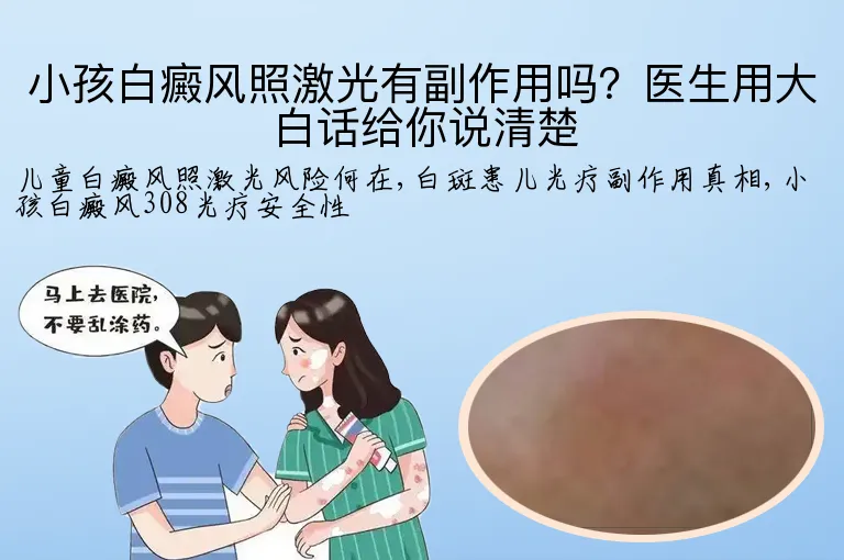 小孩白癜风照激光有副作用吗？医生用大白话给你说清楚