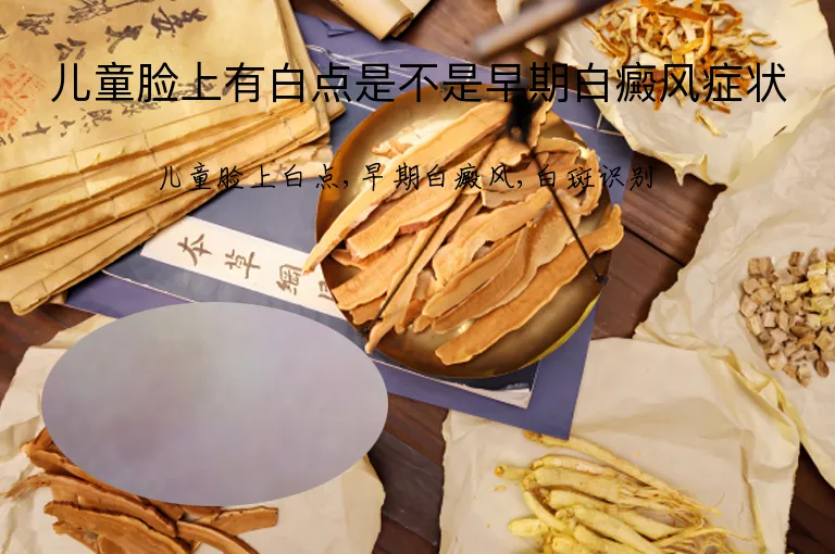 儿童脸上有白点是不是早期白癜风症状