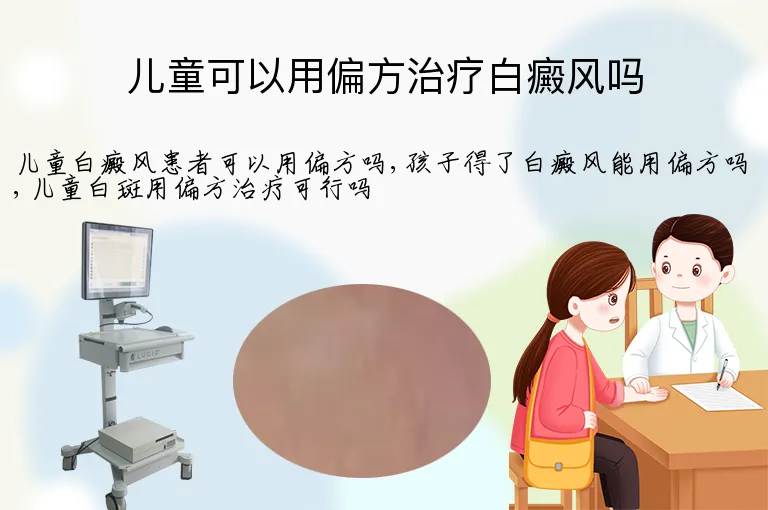 儿童可以用偏方治疗白癜风吗