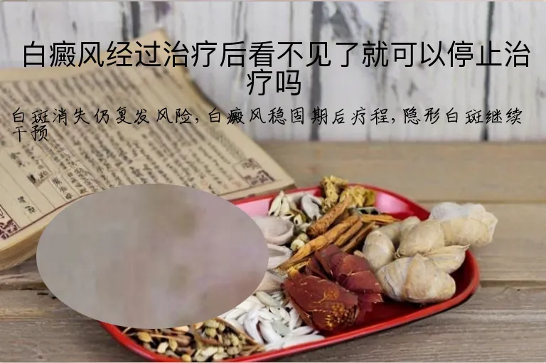 白癜风经过治疗后看不见了就可以停止治疗吗