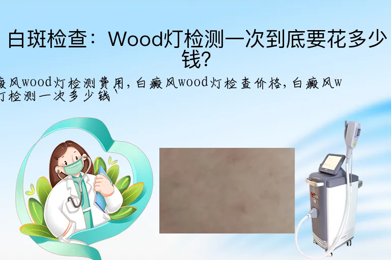 白斑检查：Wood灯检测一次到底要花多少钱？