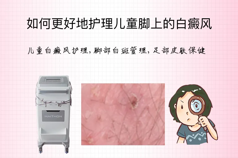 如何更好地护理儿童脚上的白癜风