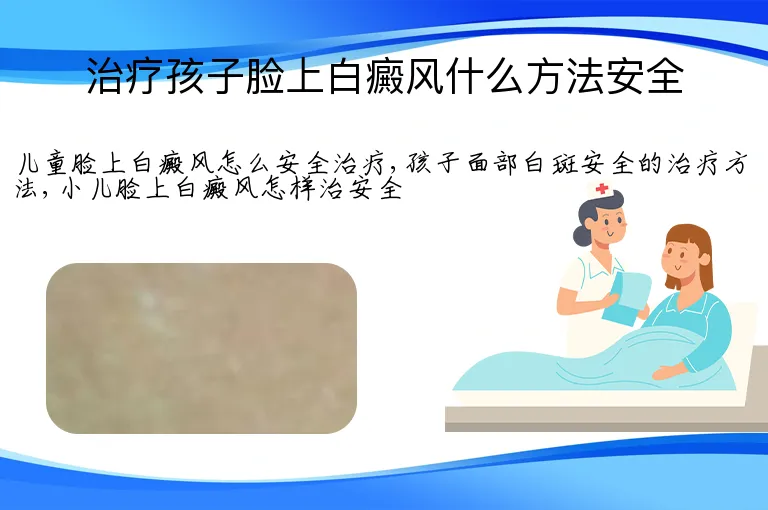 治疗孩子脸上白癜风什么方法安全