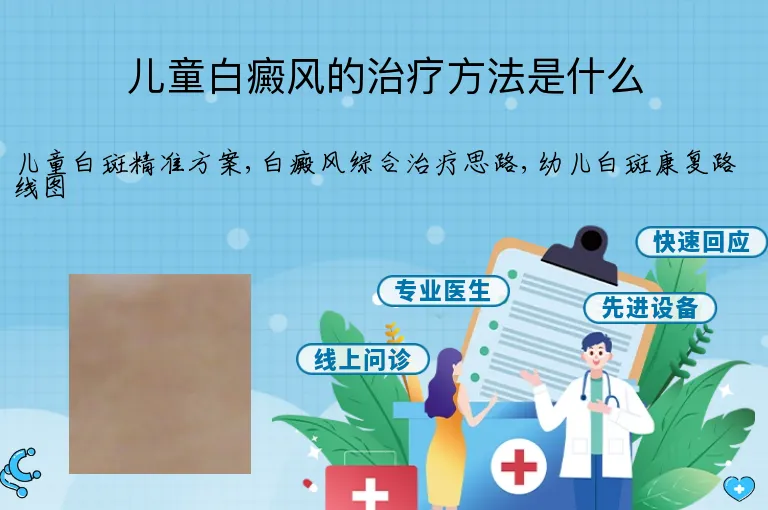 儿童白癜风的治疗方法是什么