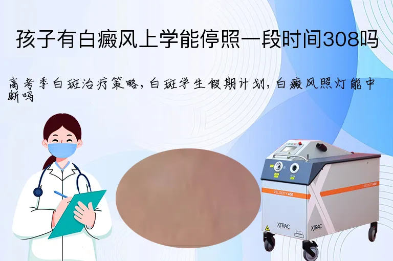 孩子有白癜风上学能停照一段时间308吗
