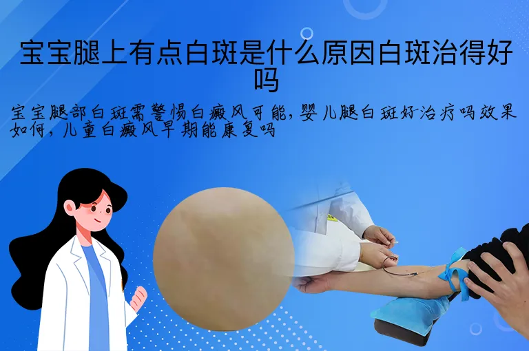 宝宝腿上有点白斑是什么原因白斑治得好吗