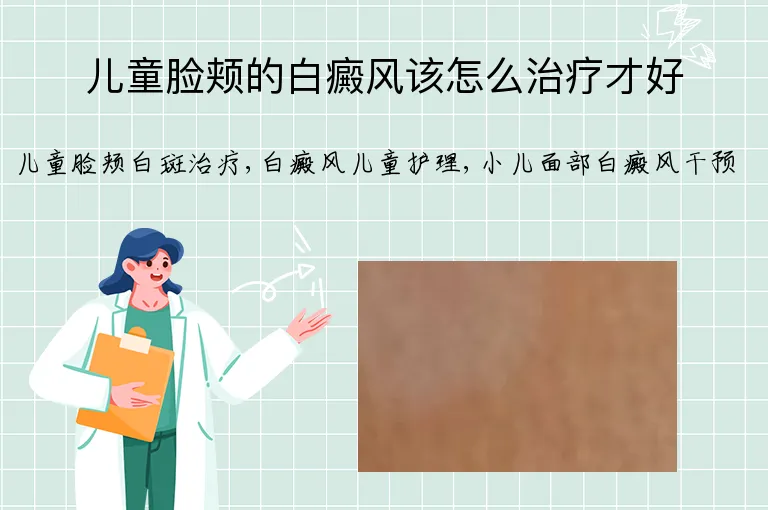 儿童脸颊的白癜风该怎么治疗才好