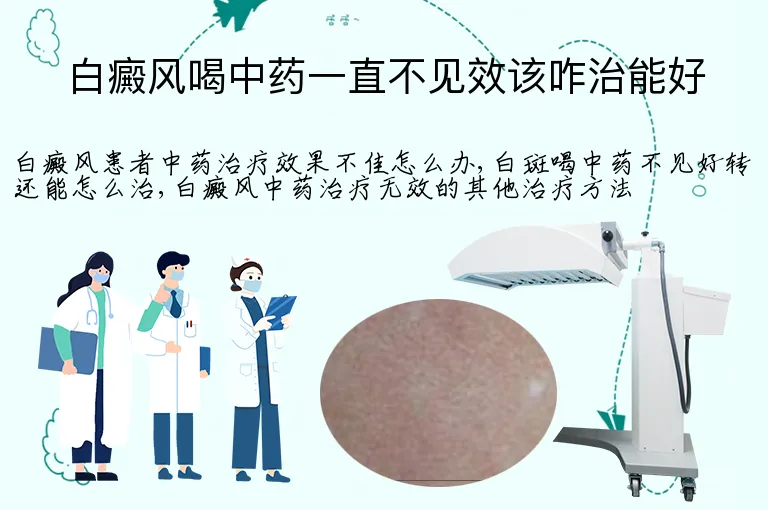 白癜风喝中药一直不见效该咋治能好