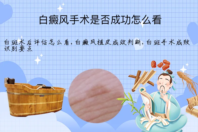 白癜风手术是否成功怎么看