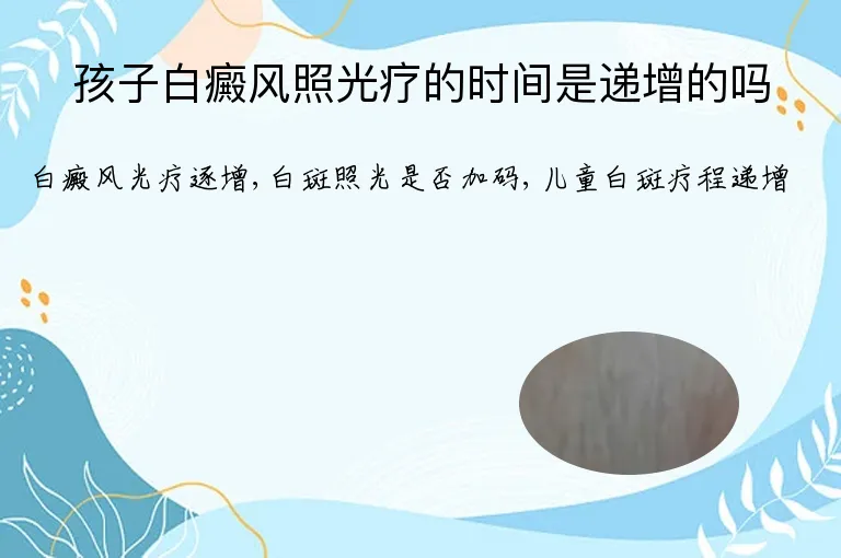 孩子白癜风照光疗的时间是递增的吗