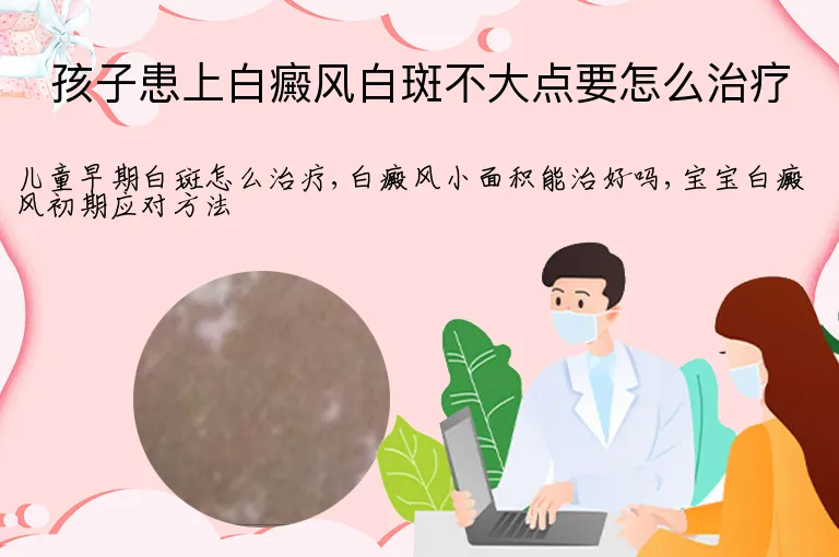 孩子患上白癜风白斑不大点要怎么治疗