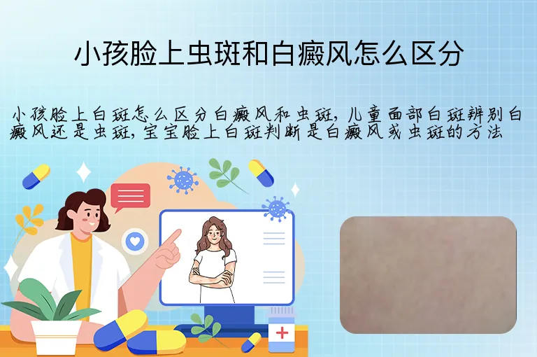 小孩脸上虫斑和白癜风怎么区分