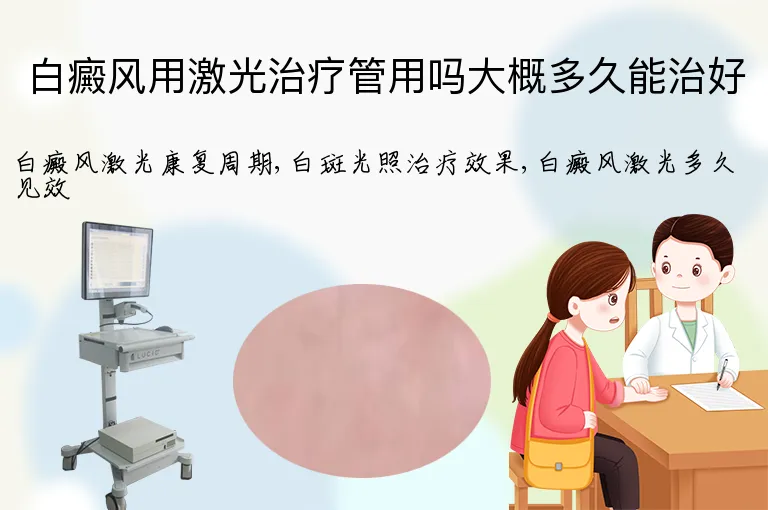 白癜风用激光治疗管用吗大概多久能治好