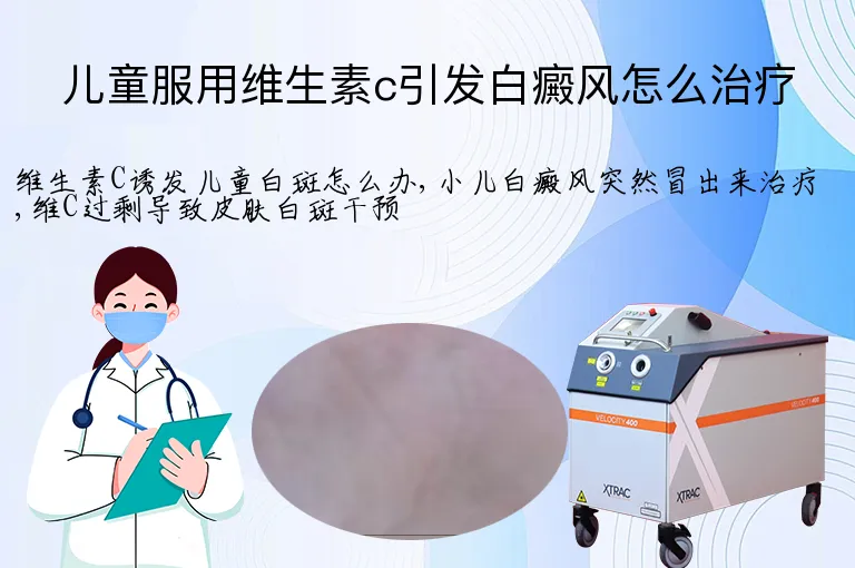 儿童服用维生素c引发白癜风怎么治疗