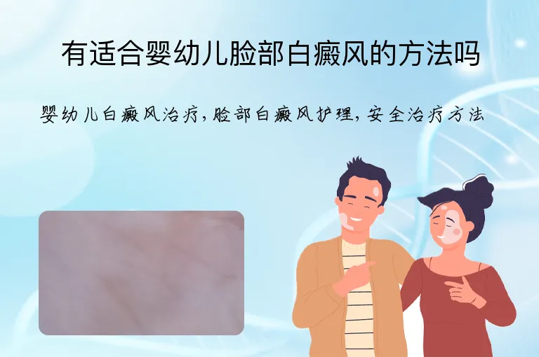 有适合婴幼儿脸部白癜风的方法吗