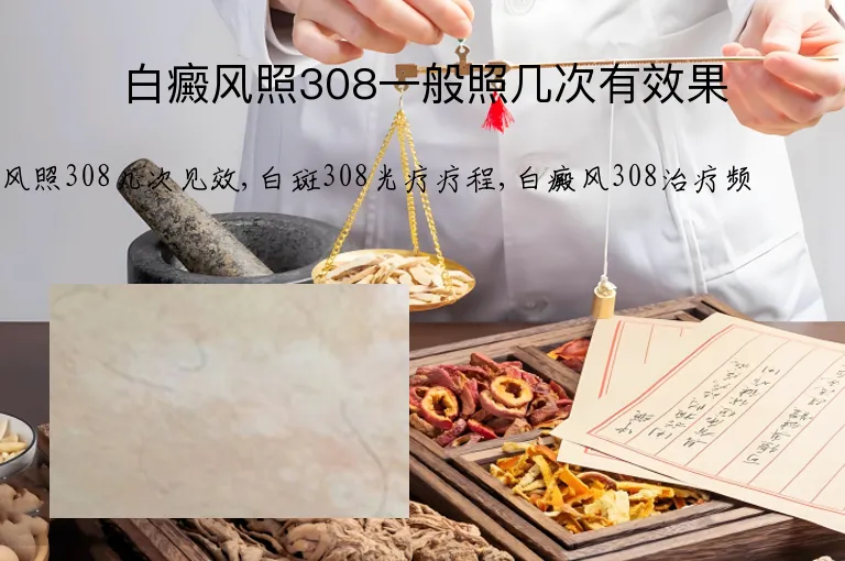 白癜风照308一般照几次有效果