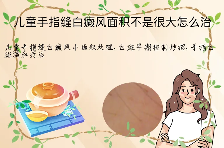 儿童手指缝白癜风面积不是很大怎么治