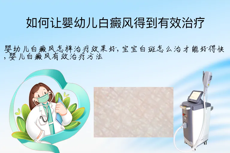 如何让婴幼儿白癜风得到有效治疗