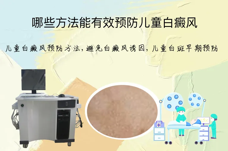 哪些方法能有效预防儿童白癜风