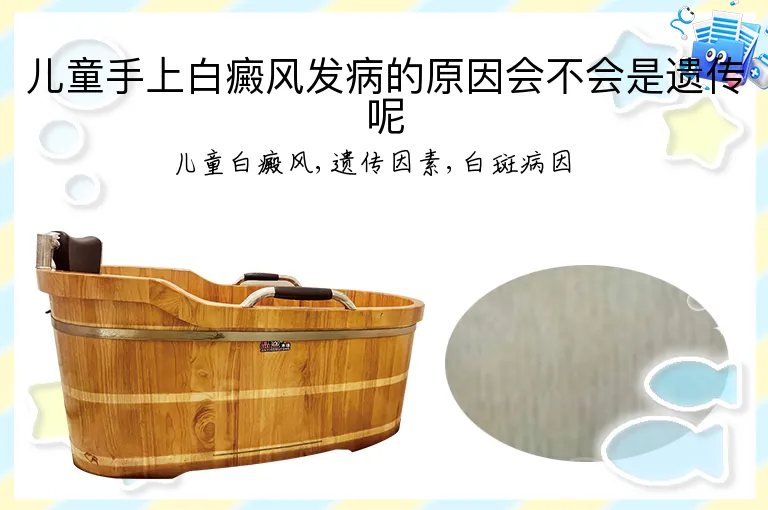 儿童手上白癜风发病的原因会不会是遗传呢