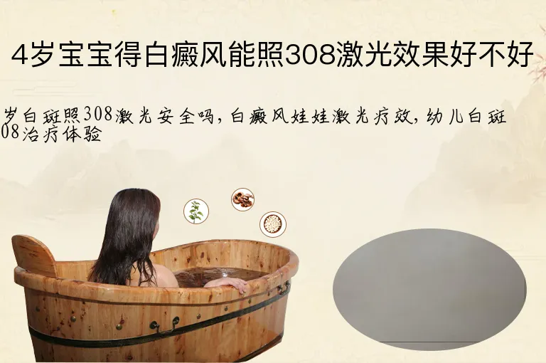 4岁宝宝得白癜风能照308激光效果好不好