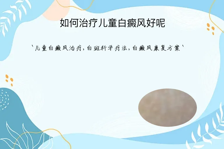 如何治疗儿童白癜风好呢