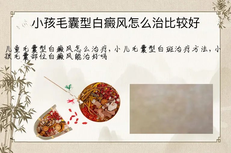 小孩毛囊型白癜风怎么治比较好