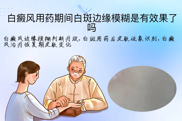 白癜风用药期间白斑边缘模糊是有效果了吗
