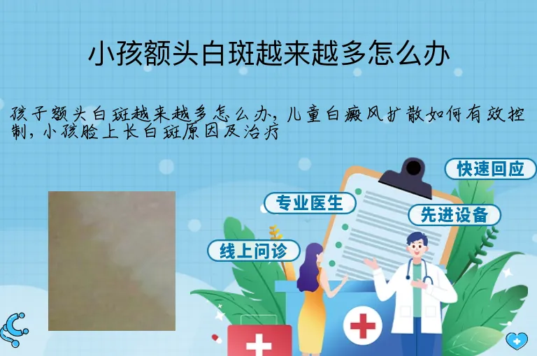 小孩额头白斑越来越多怎么办