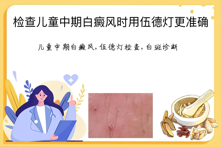 检查儿童中期白癜风时用伍德灯更准确