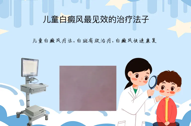 儿童白癜风最见效的治疗法子