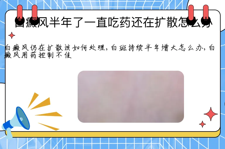 白癜风半年了一直吃药还在扩散怎么办