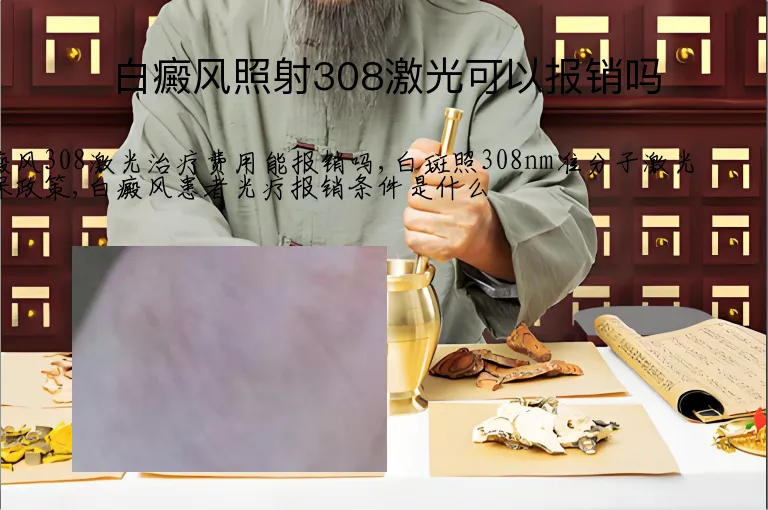 白癜风照射308激光可以报销吗