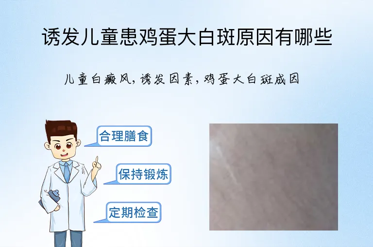 诱发儿童患鸡蛋大白斑原因有哪些