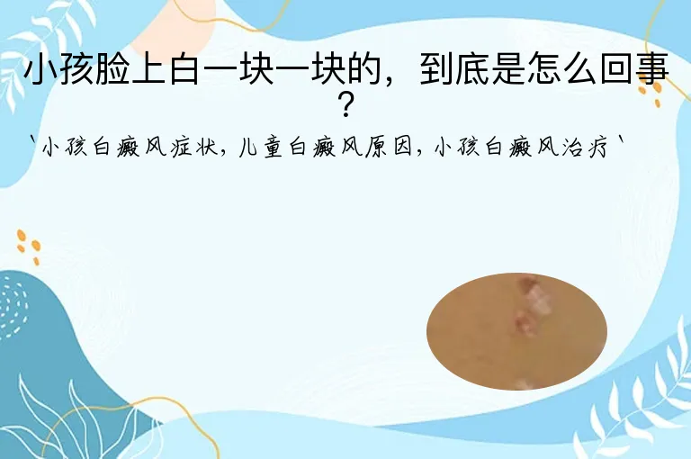 小孩脸上白一块一块的，到底是怎么回事？
