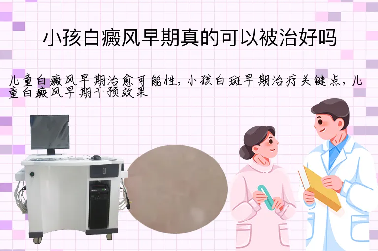 小孩白癜风早期真的可以被治好吗