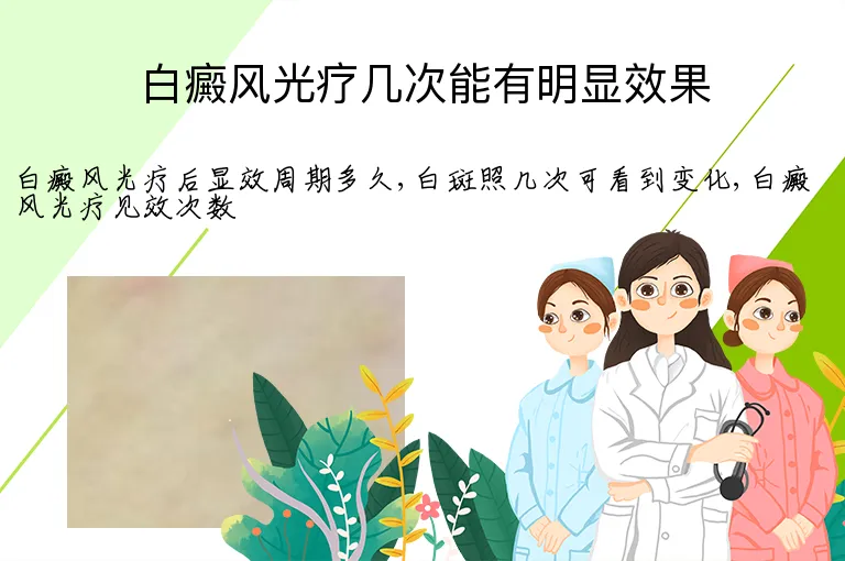 白癜风光疗几次能有明显效果